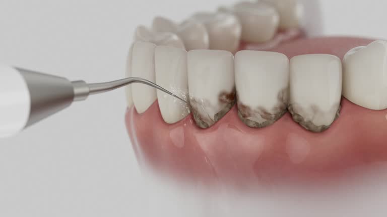 Trusted Tooth Extraction service in Ovilla, TX - Dentist Open Now